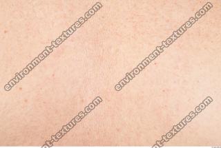 photo texture of white skin 0037